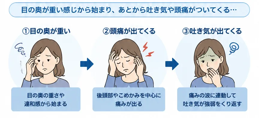 目の奥の重さから吐き気が出るまでの流れ
